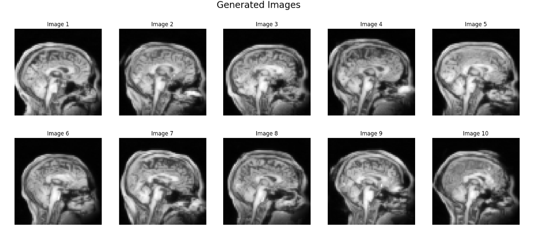 U-Net for MRI Image Inpainting